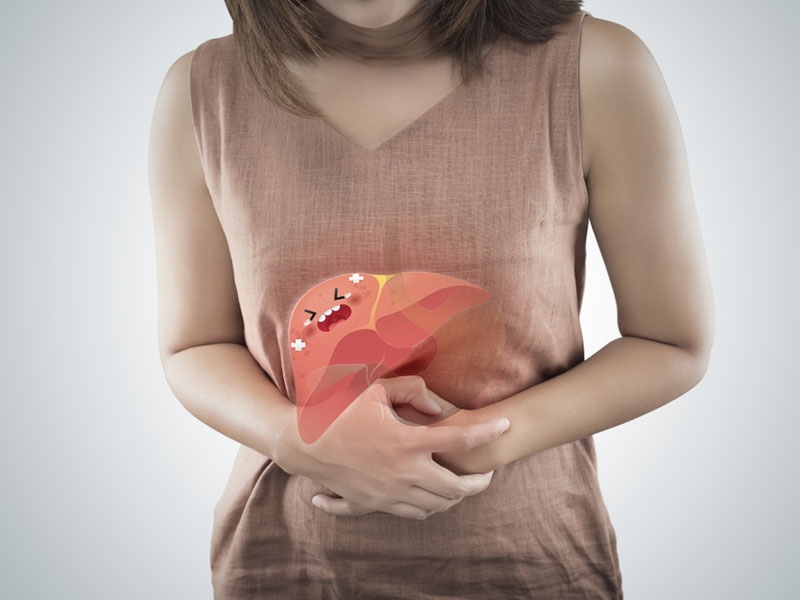 What is Fatty Liver Disease?