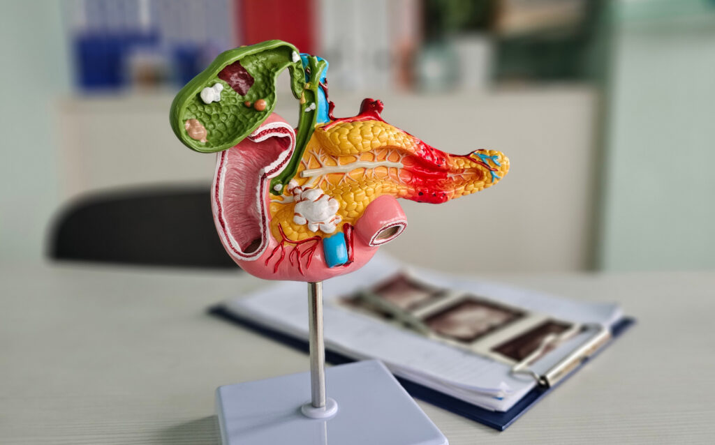 Pancreas and gallbladder anatomy displayed on a table.