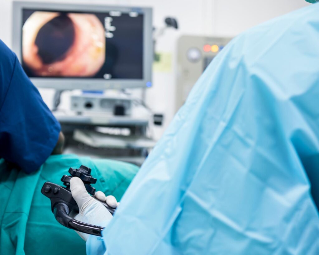 Gastroscopy procedure in Singapore.